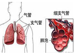 间质性肺病治疗有哪些注意事项要点