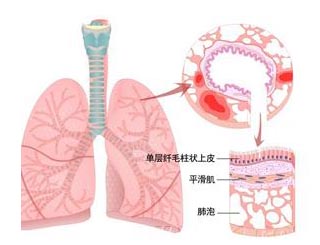 职业性哮喘的危害有哪些？